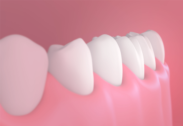 Treatment - brixtonsmiles